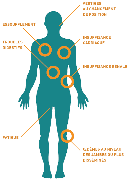 Amylose AL