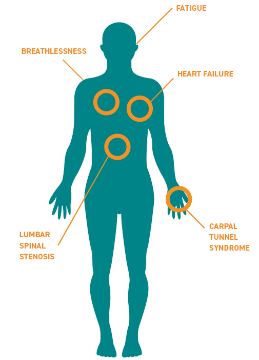 Amyloidosis - World Amyloidosis Day