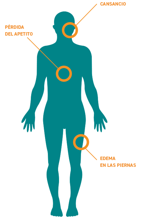 Amiloidosis AA