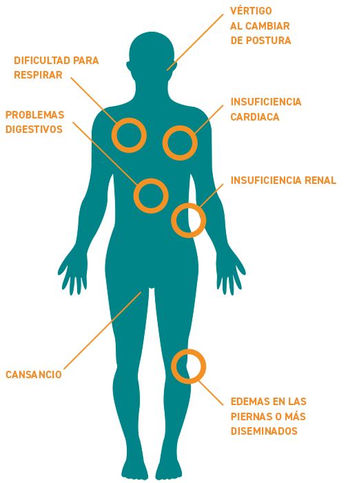 Amiloidosis AL