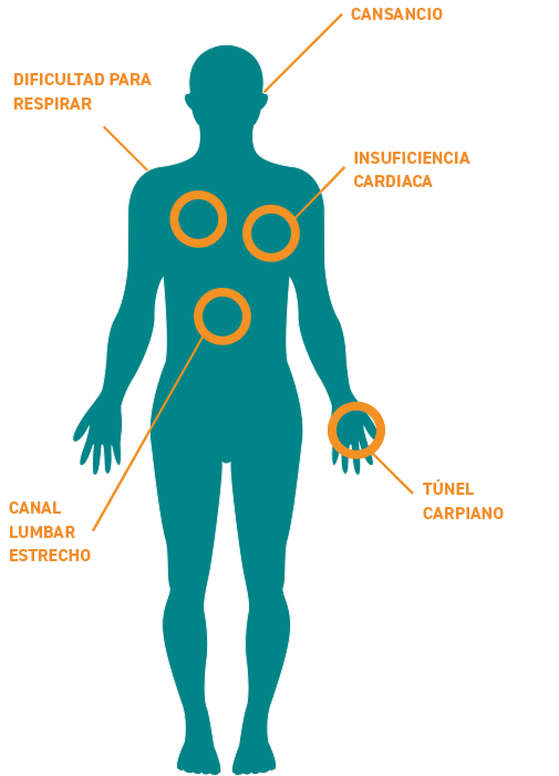 Amiloidosis Wt-TTR