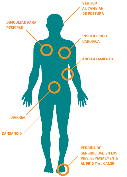 Amiloidosis h-ATTR